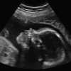 Rare Pro-Life Victory In California? Cute-Baby-700x467-e944d5879566a667ad0faf888986c0d663d0df29